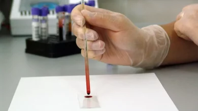 В Новосибирске ученые модифицировали фрагменты ДНК для терапии спинальной мышечной атрофии